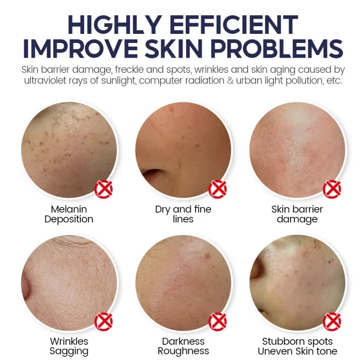 Niacinamide 5% Serum + Retinol Cream Set - Anti-Aging Skin Barrier Repair Bwetinde B Enterprises