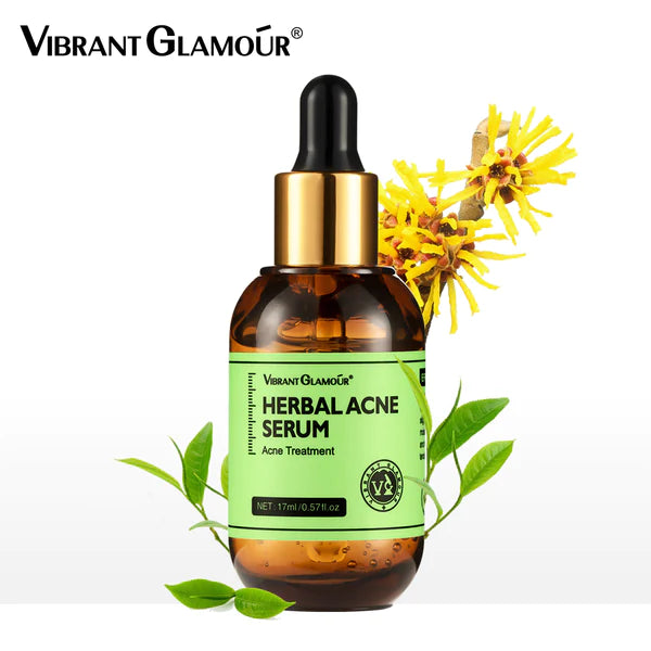 VIBRANT GLAMOUR Herbal Acne Treatment Serum 17ml Bwetinde B Enterprises
