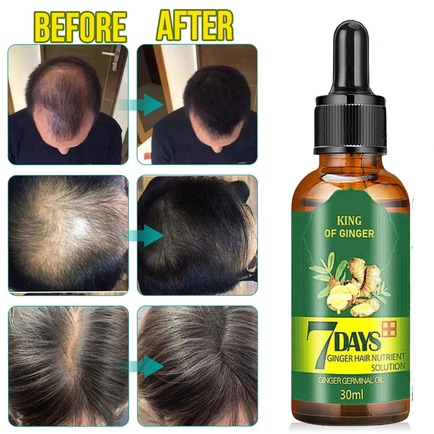 7 Day Hair Growth Treatment 30ml - Ginger Serum for Hair Loss Bwetinde B Enterprises