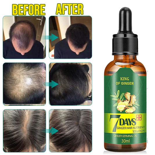 7 Day Hair Growth Treatment 30ml - Ginger Serum for Hair Loss Bwetinde B Enterprises