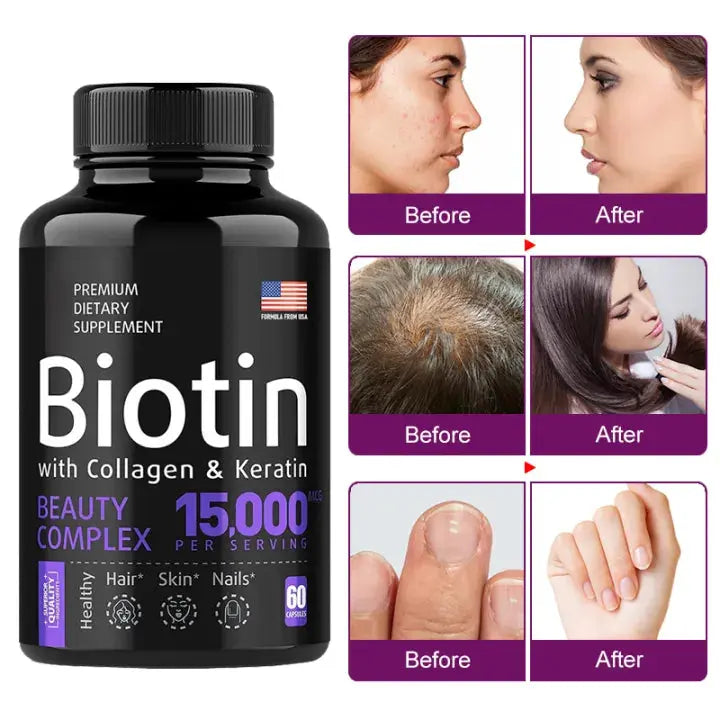 Biotin Capsule with Collagen and Keratin (15,000mcg) | Beauty Supplement for Hair, Skin, and Nail Care Bwetinde B Enterprises