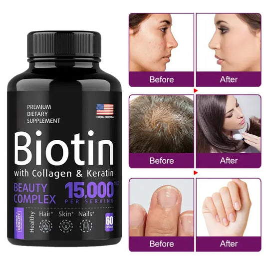 Biotin Capsule with Collagen and Keratin (15,000mcg) | Beauty Supplement for Hair, Skin, and Nail Care Bwetinde B Enterprises