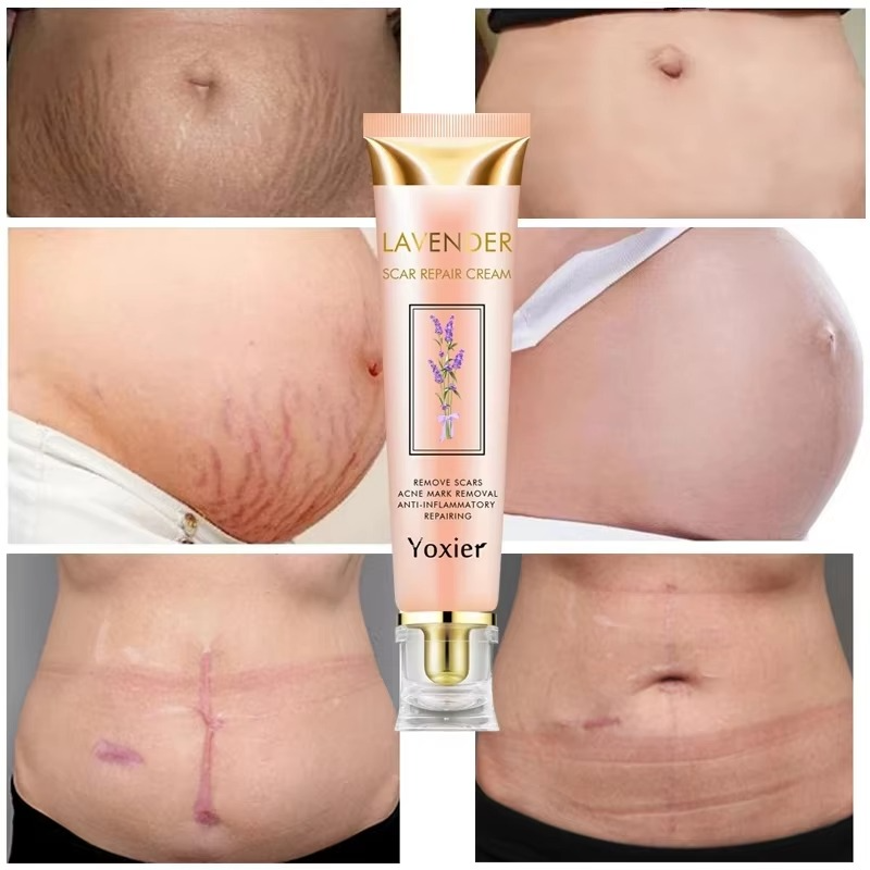 Yoxier Lavender Scar Repair Cream Bwetinde Business Enterprises