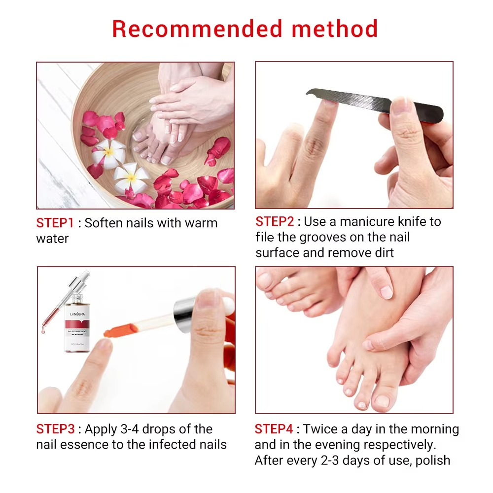 LANBENA Nail Repair Serum Feet Care Strength Liquid for Damaged Nails