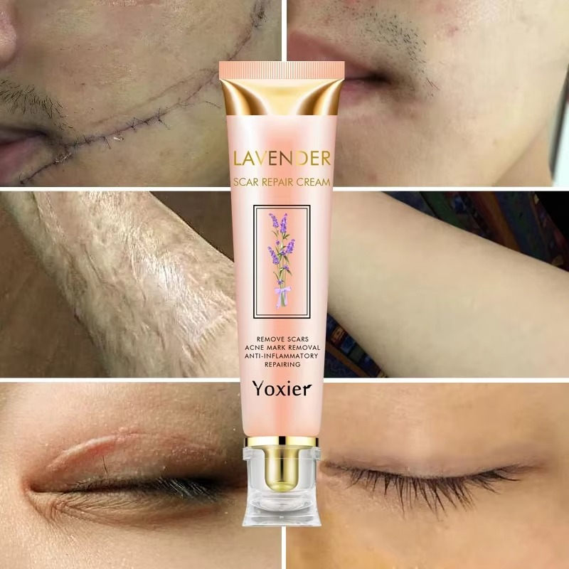 Yoxier Lavender Scar Repair Cream Bwetinde Business Enterprises
