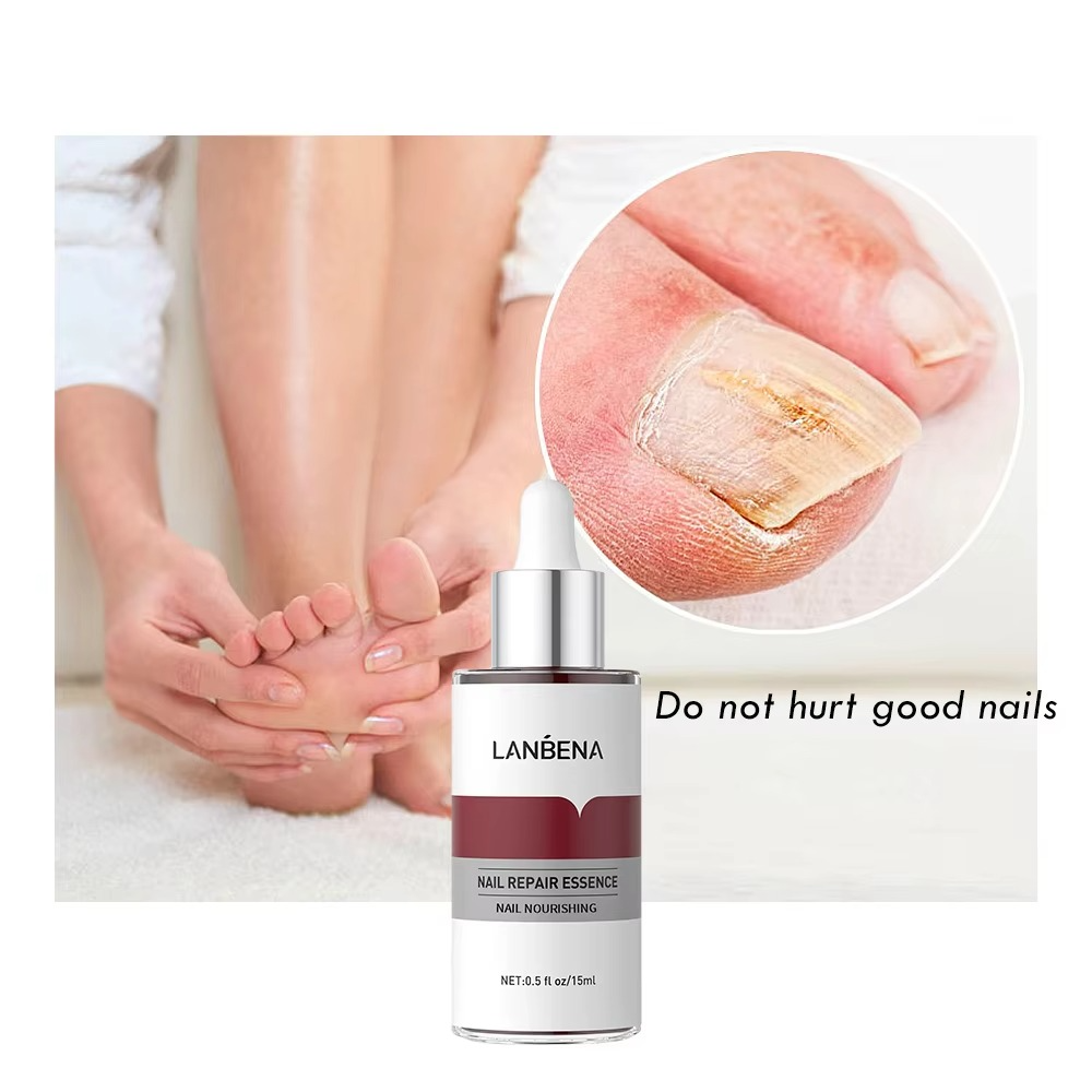 LANBENA Nail Repair Serum Feet Care Strength Liquid for Damaged Nails
