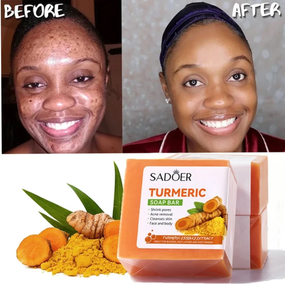 Turmeric Soap Bar - Handmade for Acne, Dark Spots & Smooth Skin Bwetinde B Enterprises