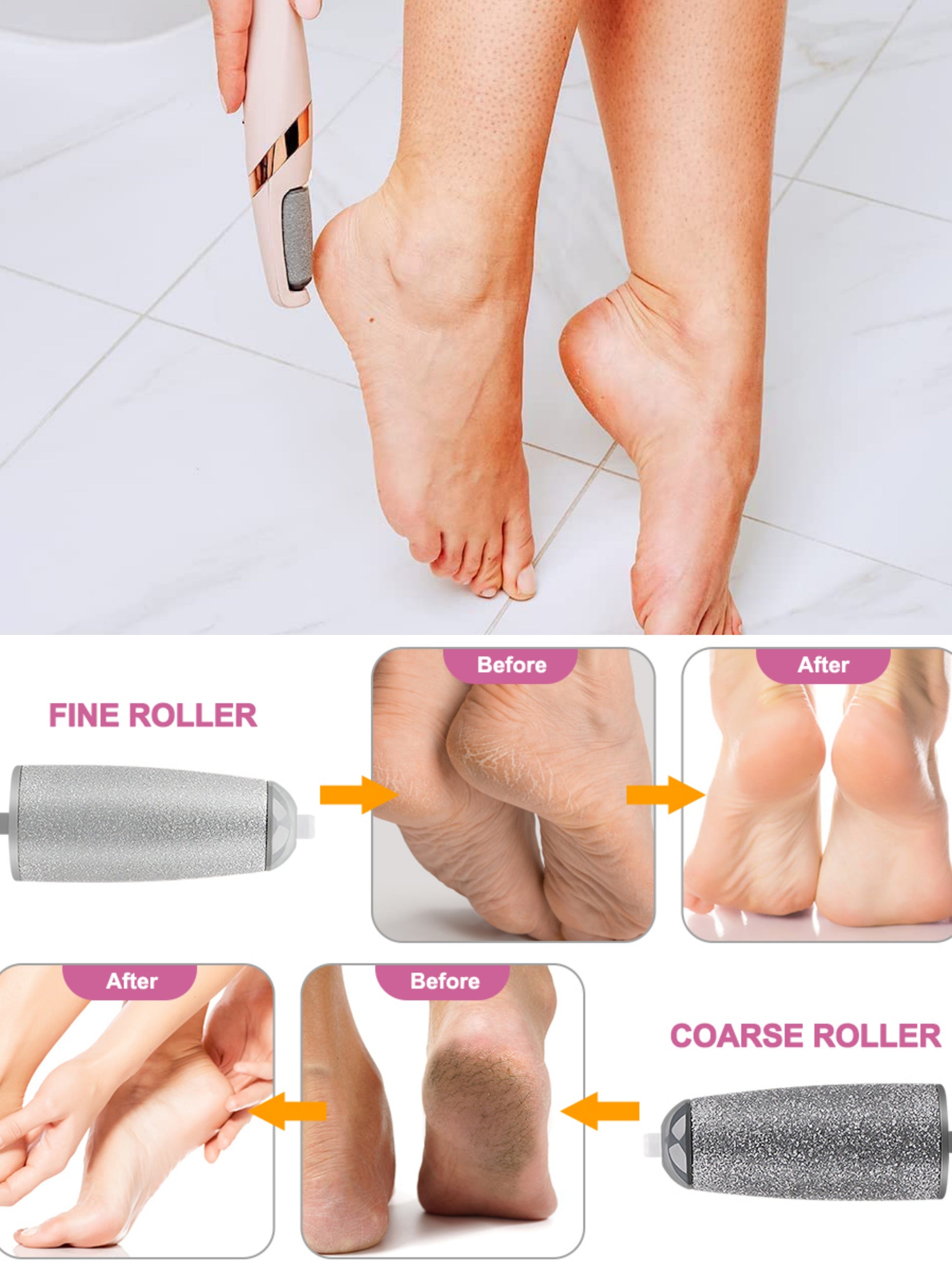 Electric Foot Grinder - Rechargeable Callus Remover with Vacuum Bwetinde B Enterprises