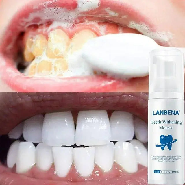 LANBENA teeth whitening mousse Bwetinde B Enterprises