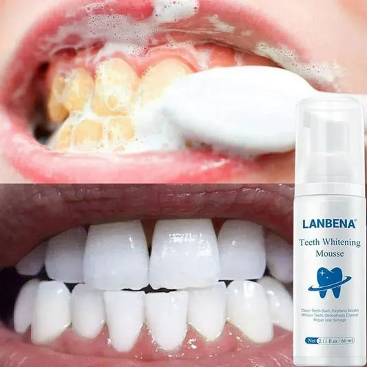 LANBENA teeth whitening mousse Bwetinde B Enterprises