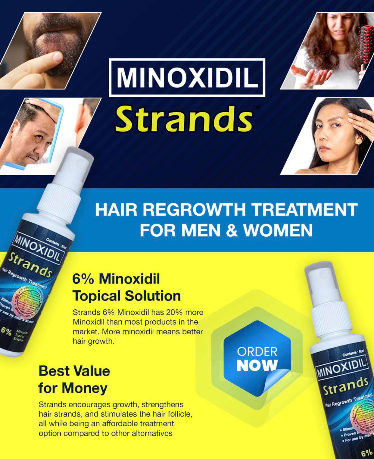 Minoxidil 6% Hair & Beard Growth Solution - Strands Topical Treatment Bwetinde Business Enterprises
