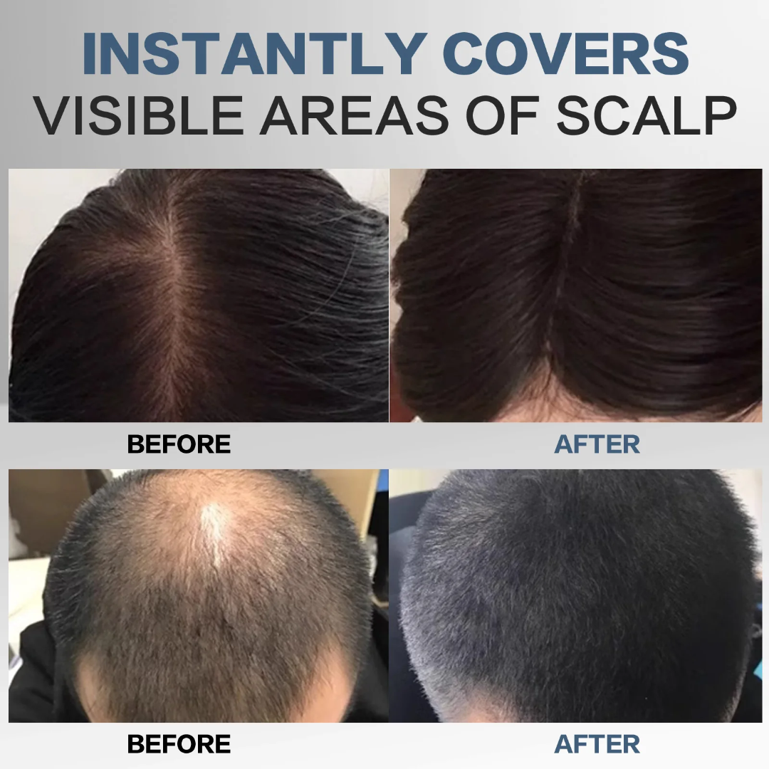 Aliver Hair Shadow Powder - Instant Root Touch Up & Coverage, Hair Building Fibers Bwetinde Business Enterprises