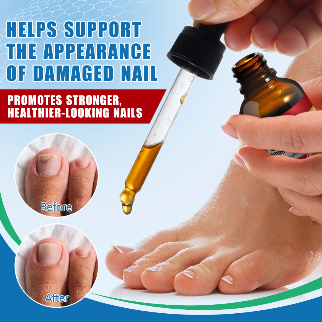 Tivlon Toenail Fungus Treatment - Liquid Solution for Nail Fungus Bwetinde Business Enterprises