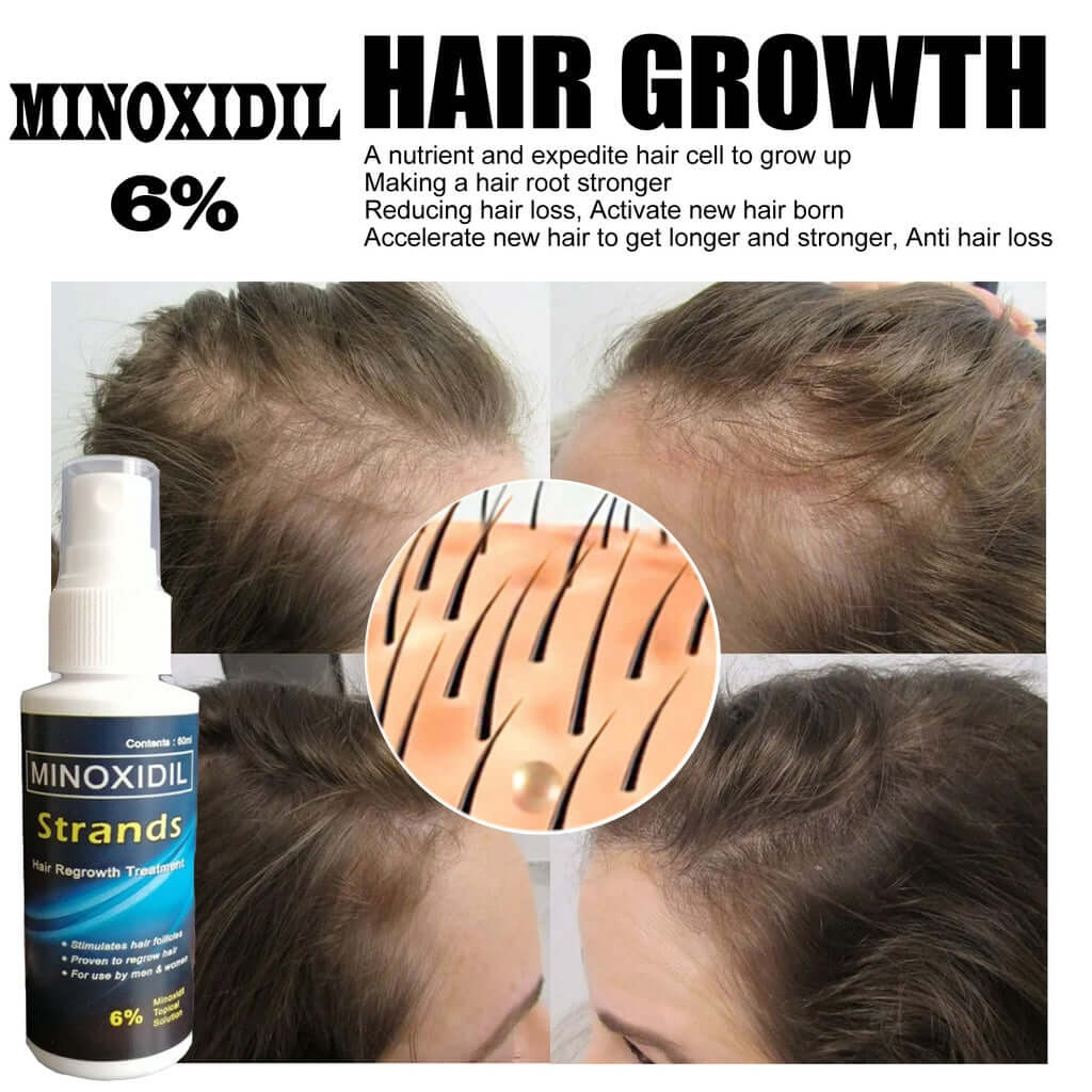 Minoxidil 6% Hair & Beard Growth Solution - Strands Topical Treatment Bwetinde Business Enterprises