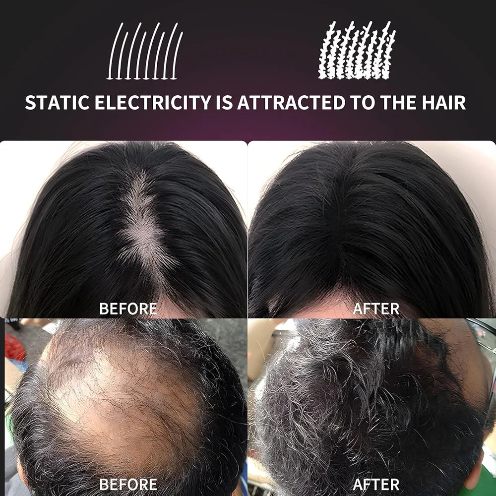 Sevich Hair Fibers 40g - Instant Hair Thickener for Thinning Hair
