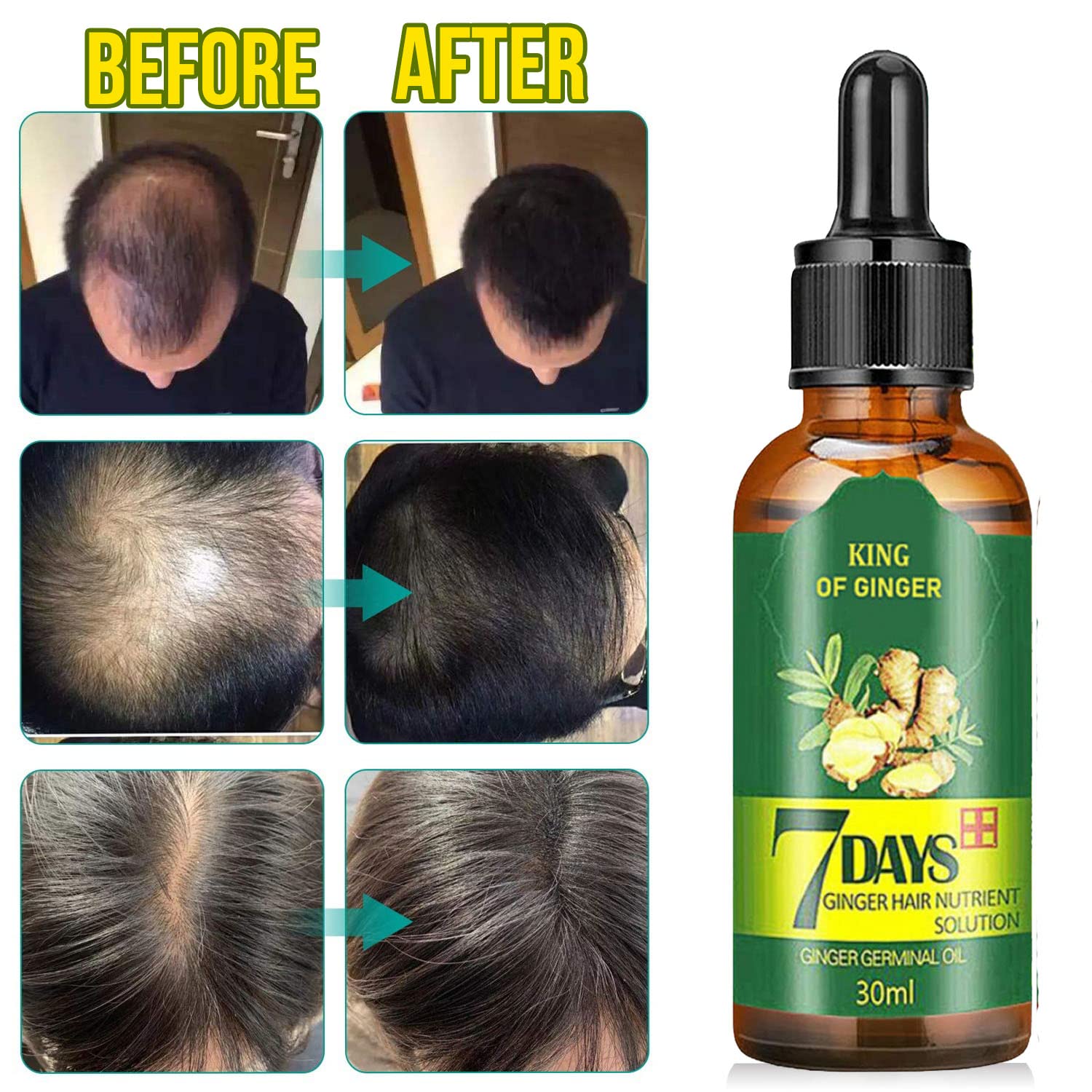 7 Day Hair Growth Treatment 30ml - Ginger Serum for Hair Loss