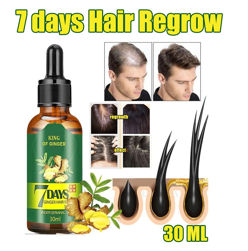 7 Day Hair Growth Treatment 30ml - Ginger Serum for Hair Loss