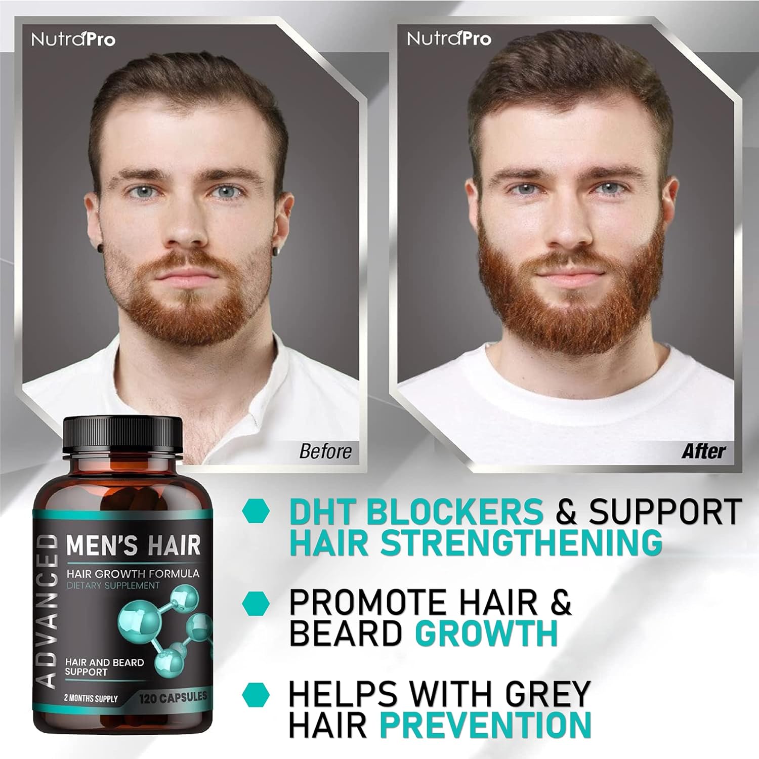 Hair Growth Vitamins for Men 120 Caps - Biotin & Saw Palmetto