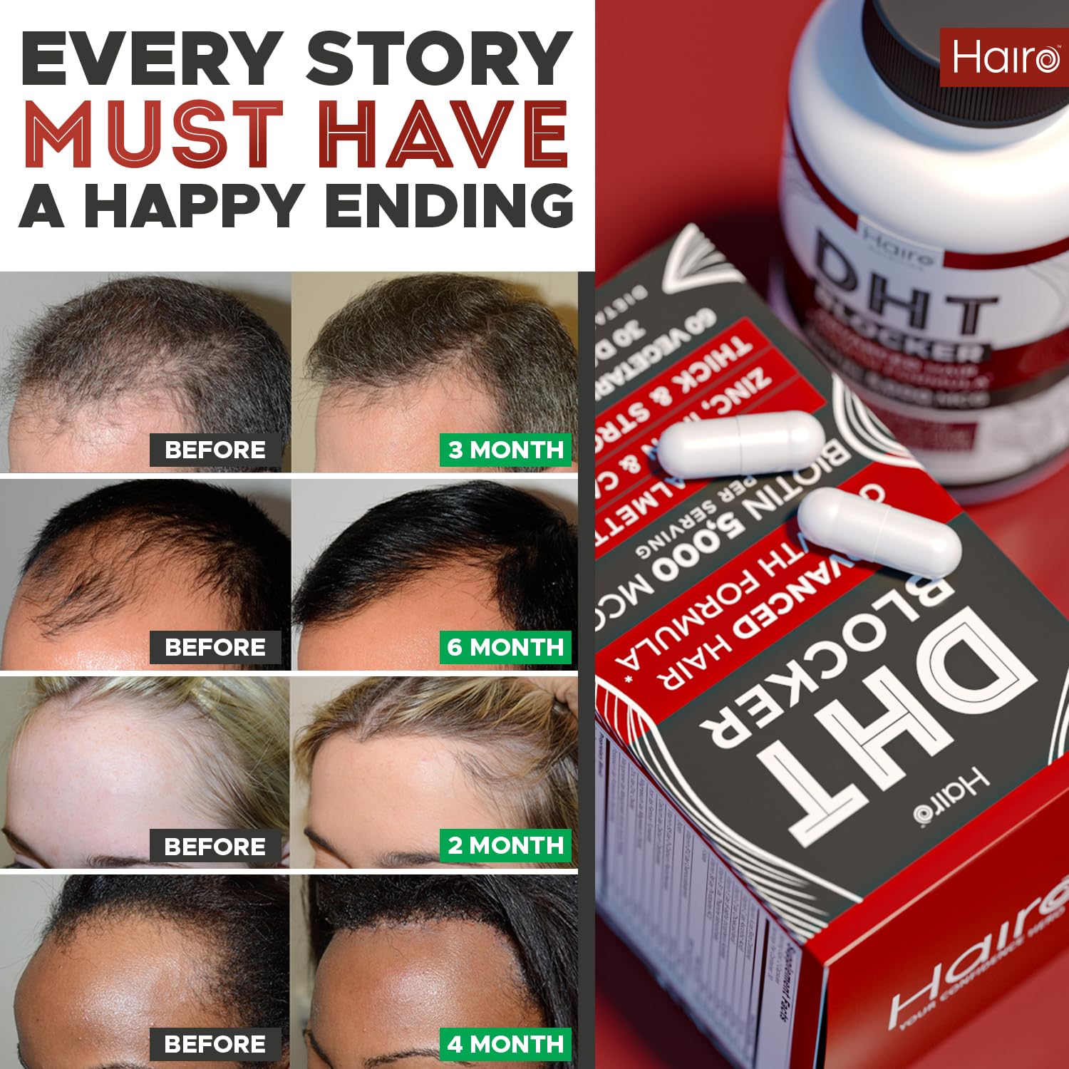 DHT Blocker Hair Growth Supplement - Biotin & Saw Palmetto for Men & Women