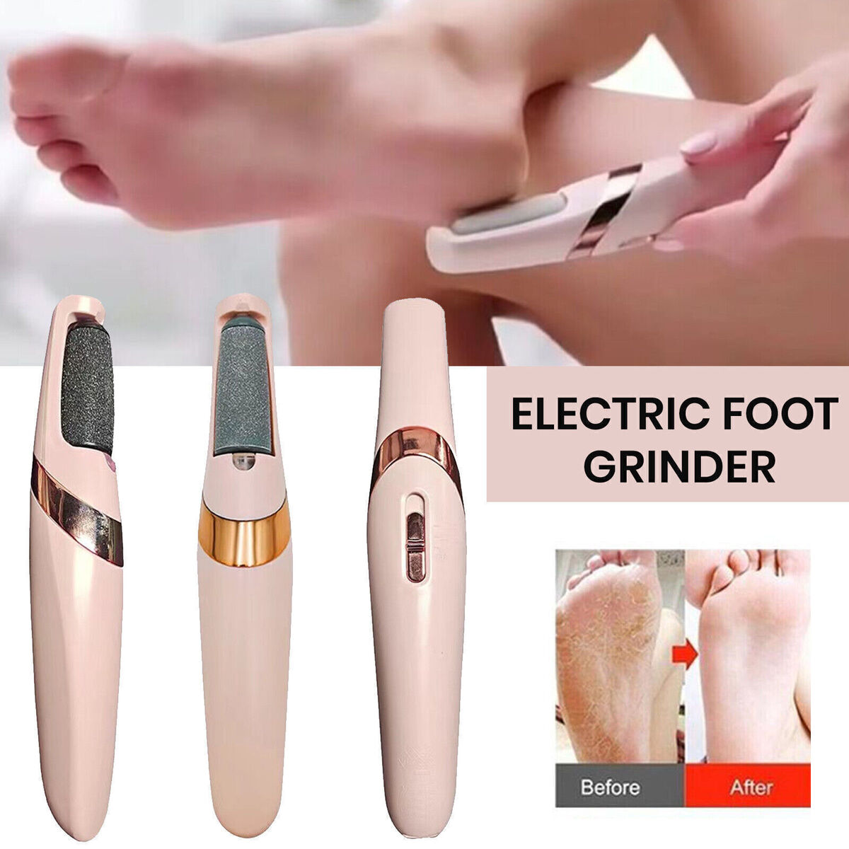 Electric Foot Grinder - Rechargeable Callus Remover with Vacuum