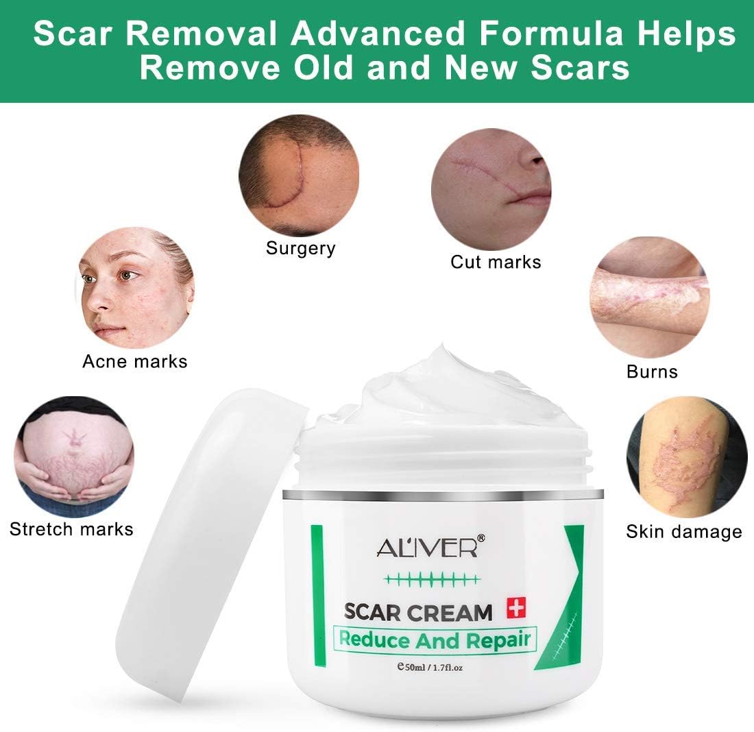Aliver Scar Removal Cream - Fades Scars, Stretch Marks & Blemishes