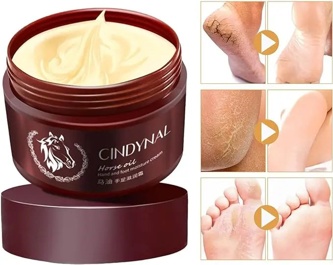 Horse Oil Hand & Foot Cream - Repairs Dry Cracked Heels