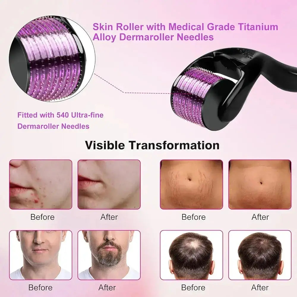 Derma Roller for Hair Growth & Beard - Microneedling for Scalp