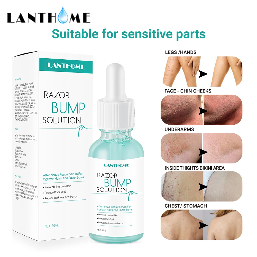 Razor Bump Solution