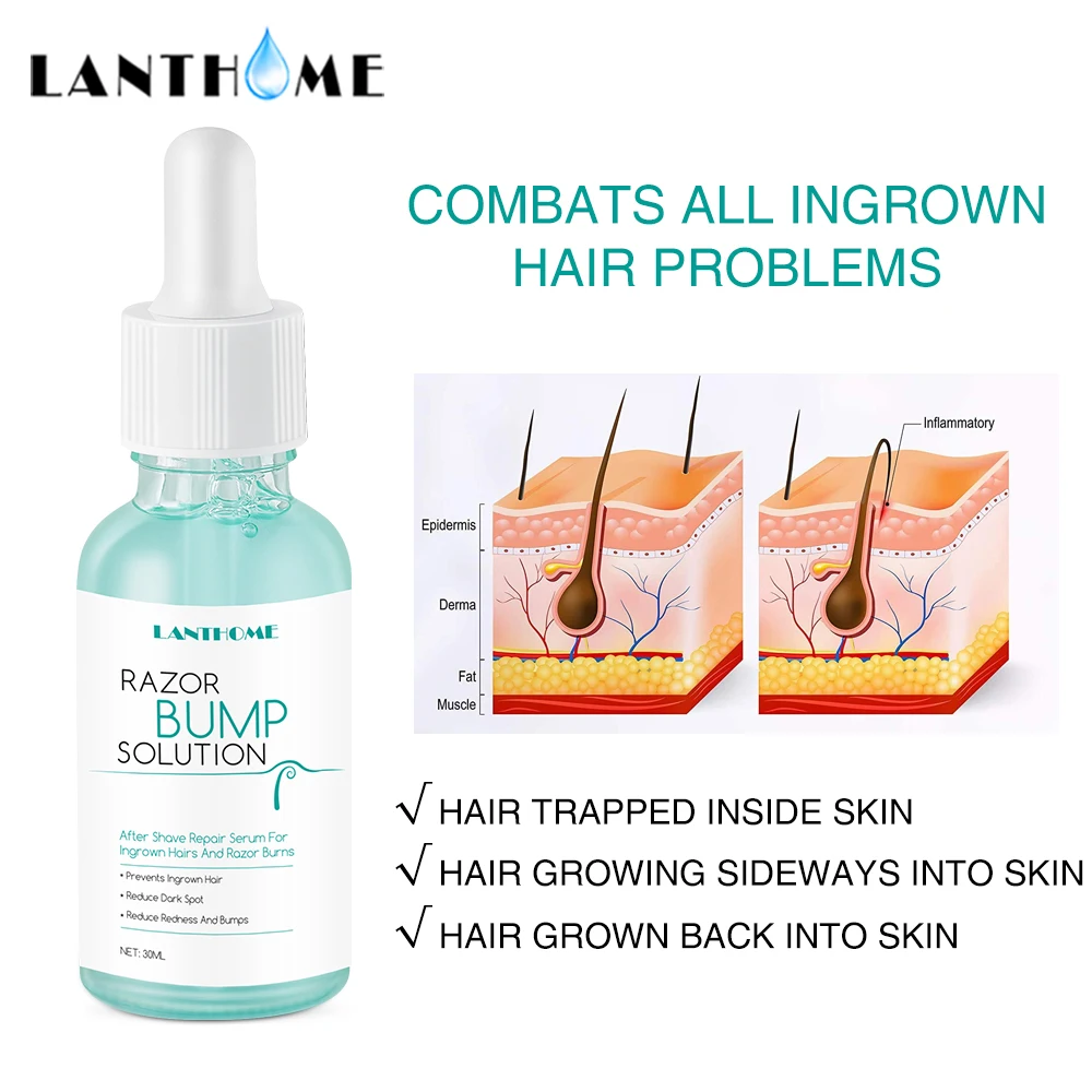 Razor Bump Solution