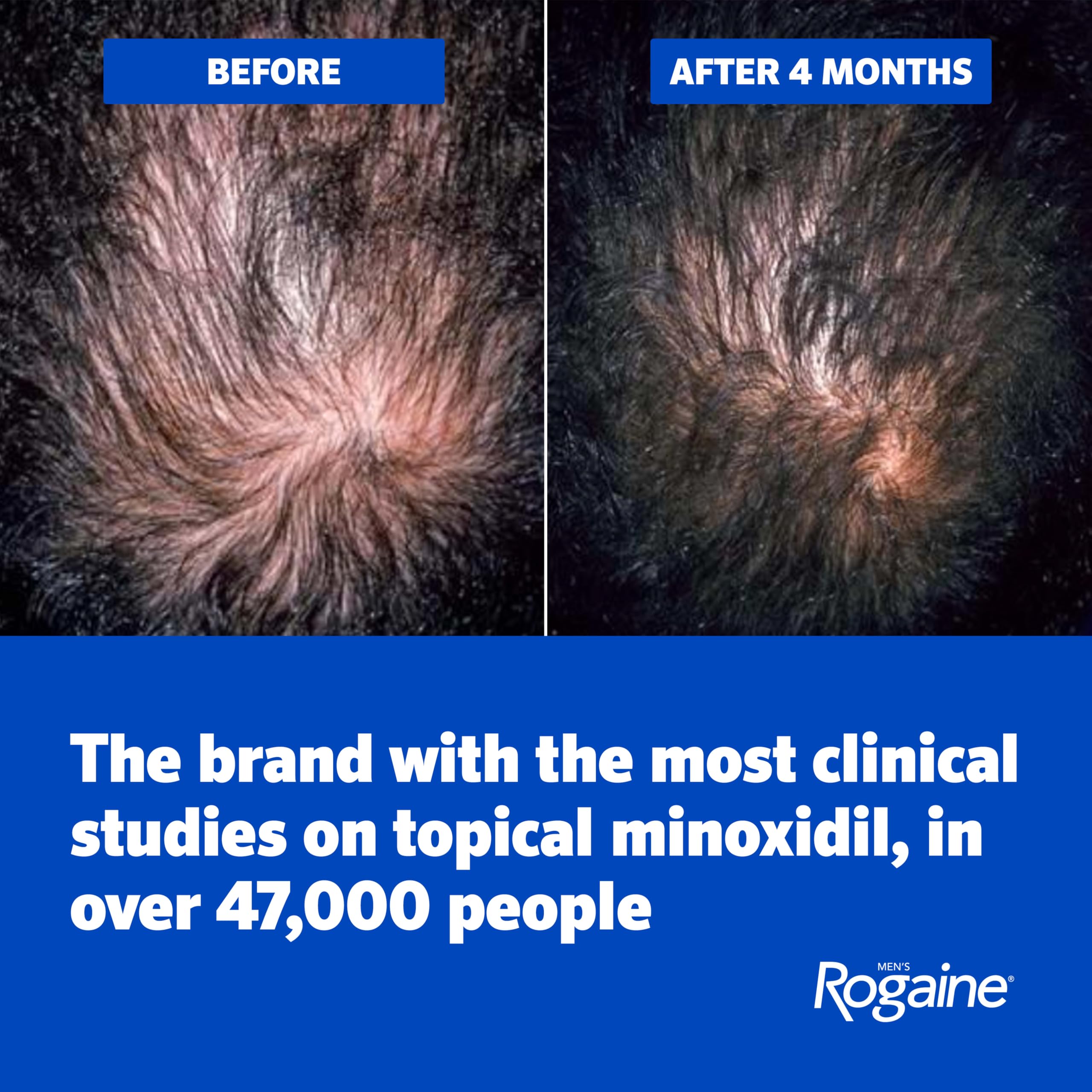 Men's ROGAINE® 5% Minoxidil Unscented Foam - 3-Month Supply
