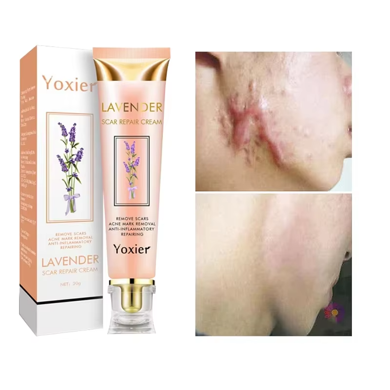 Yoxier Lavender Scar Repair Cream