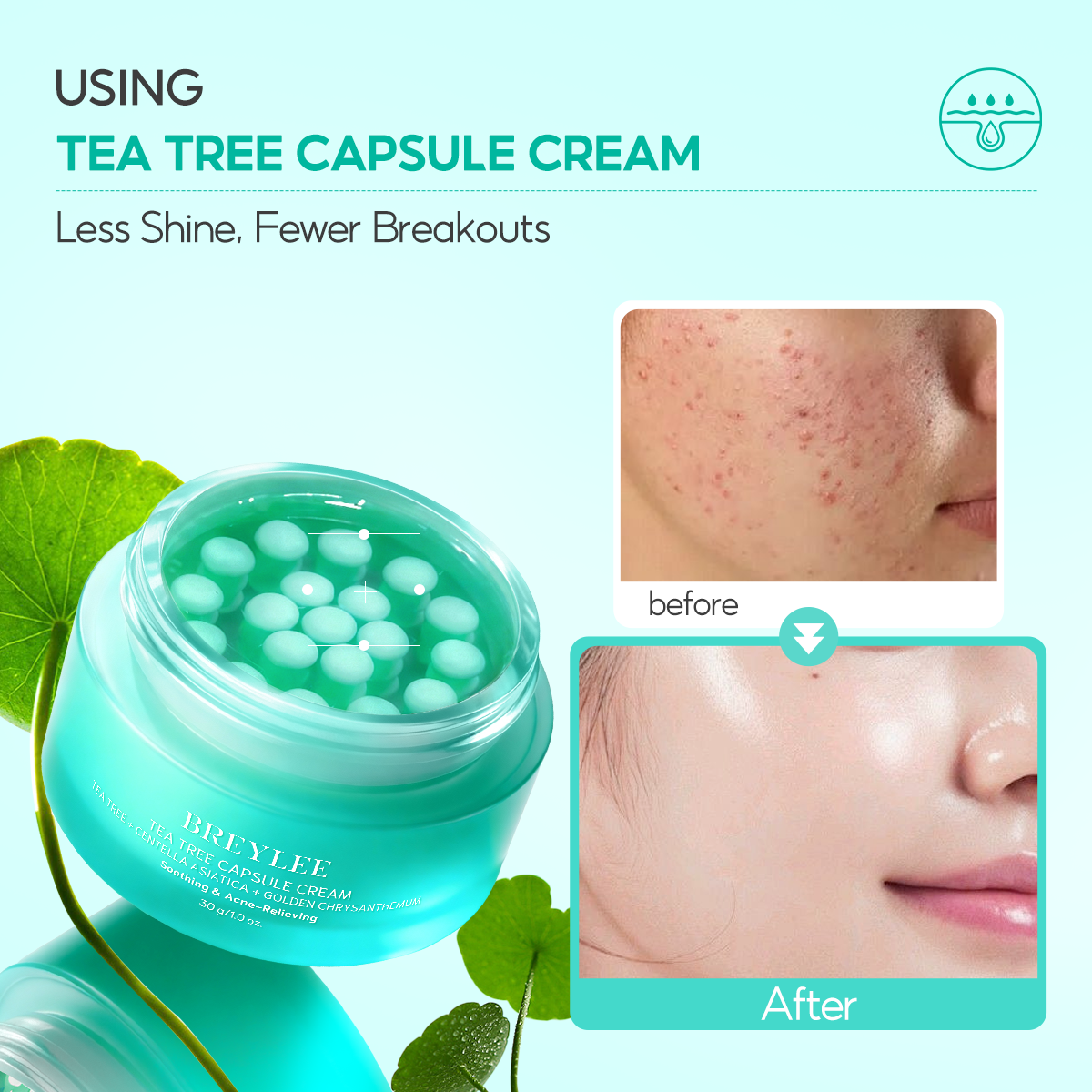 Pimples Cream
