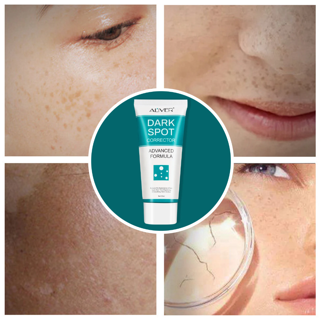 Aliver Dark Spot Remover for Face and Body, Dark Spot Corrector, Age Dark Spot Remover for Women Men, Evens and Fades Spots with Effective Formula, Hyperpigmentation, Sunspots, Melasma Treatment for Face