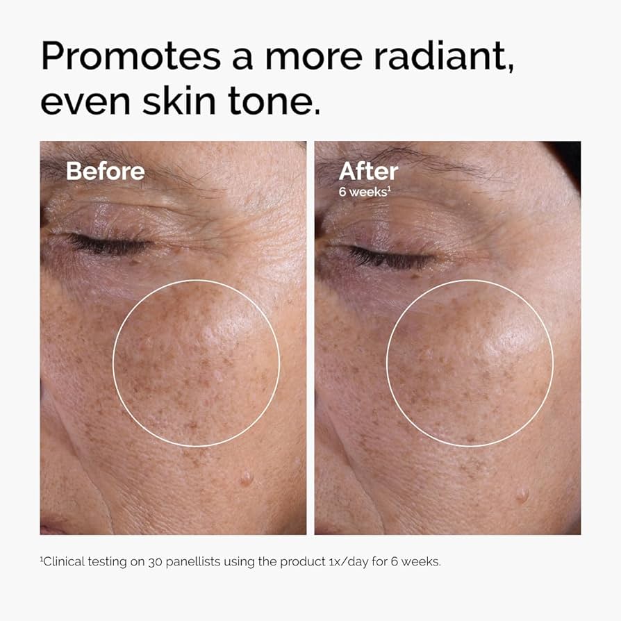 The Ordinary Glycolic Acid 7% Exfoliating Toner, Brightening and Smoothing Daily Toner for More Even-Looking Skin Tone