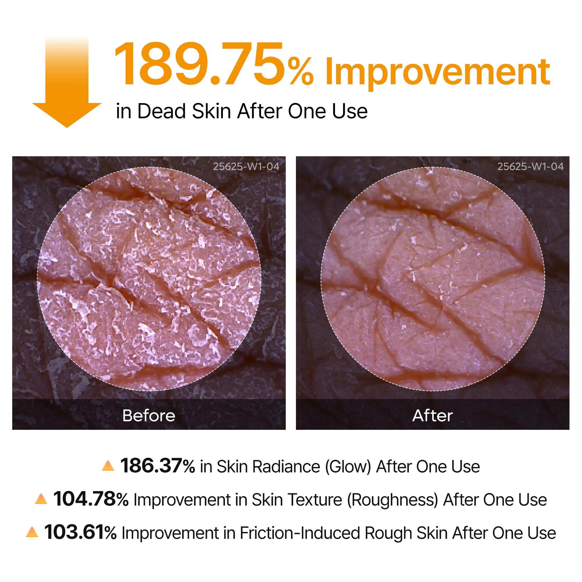 Dr.Melaxin Body Keratin Care Kojic Acid Turmeric Exfoliating Peeling Spray for Brightening and Even Tone for Face and Body All Skin Types 200ml