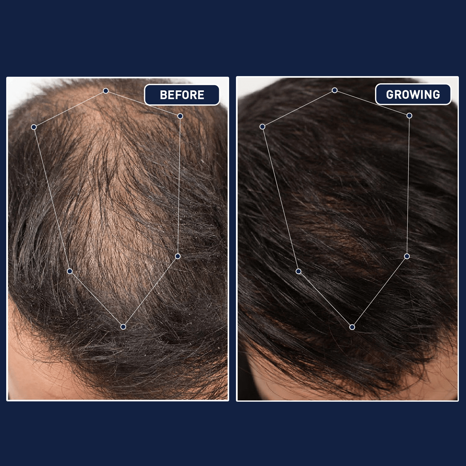 FEG Hair Growth Spray - Prevent Hair Loss & Stimulate Follicle Growth