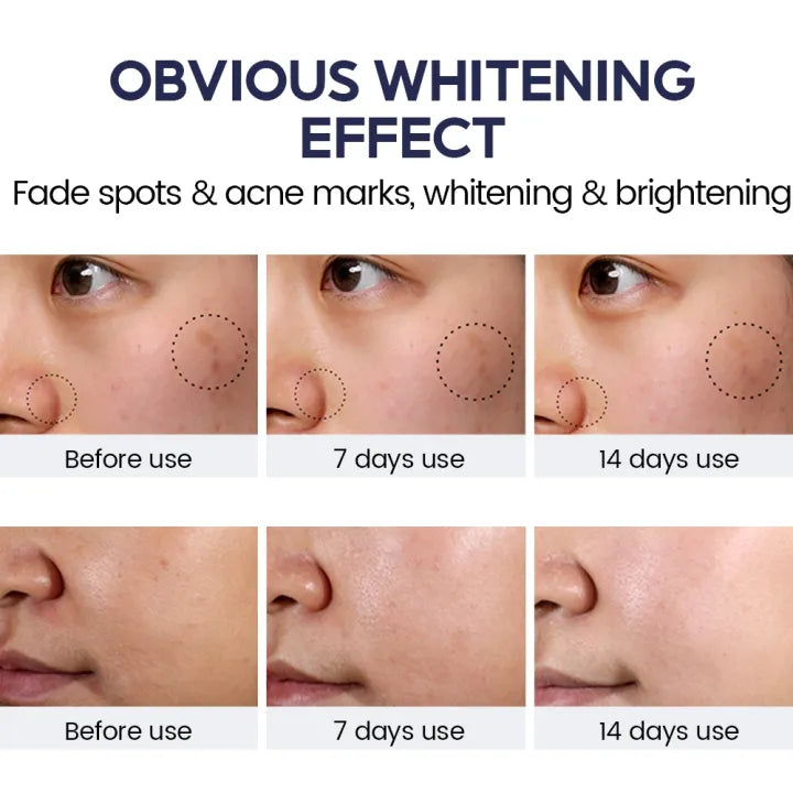 Niacinamide Brightening Set - 8% Cream + 5% Serum with 5X Ceramide